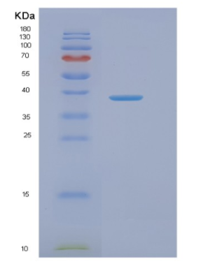 Recombinant Human NAGK Protein