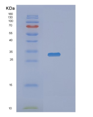 Recombinant Human NANP Protein