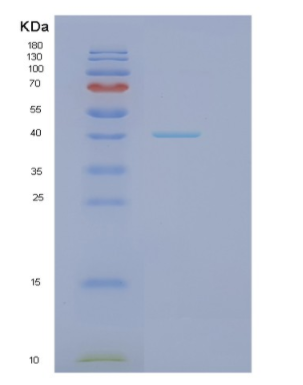 Recombinant Human NDEL1 Protein