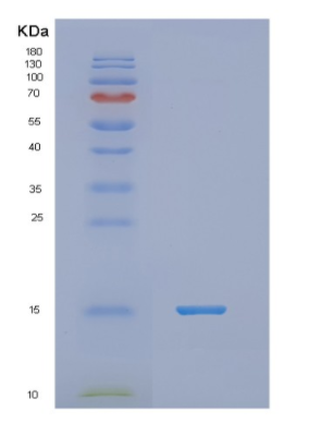 Recombinant Human NDP Protein
