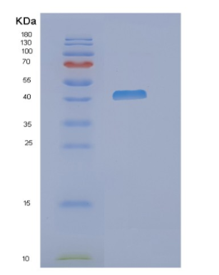 Recombinant Human NDRG3 Protein