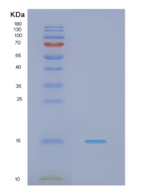 Recombinant Human NDUFS4 Protein