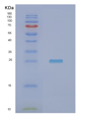 Recombinant Human NDUFV2 Protein