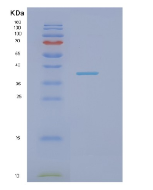Recombinant Human Nectin-1 Protein