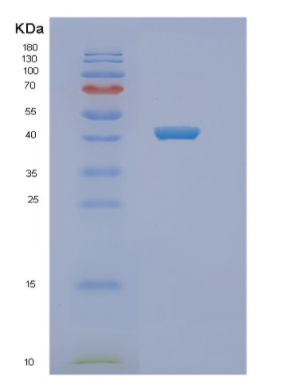 Recombinant Human NEU1 Protein