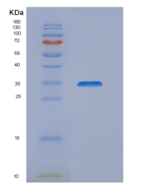 Recombinant Human NIPSNAP1 Protein