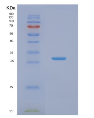 Recombinant Human NABP1 Protein