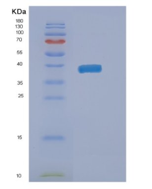 Recombinant Human NAIF1 Protein