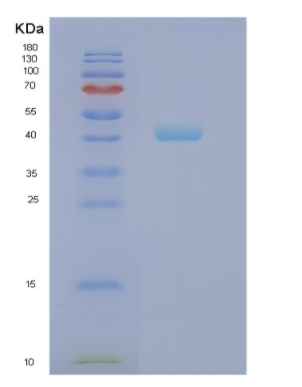 Recombinant Human NCF1 Protein