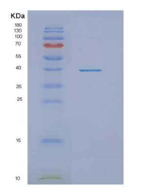 Recombinant Human NDRG1 Protein