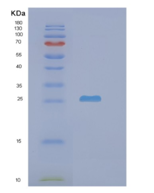 Recombinant Human N6AMT1 Protein