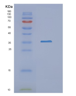 Recombinant Human NAT1 Protein