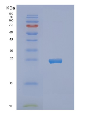 Recombinant Human NCS1 Protein