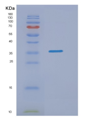 Recombinant Human NMNAT1 Protein