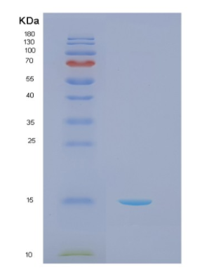 Recombinant Human NCR2 Protein
