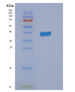 Recombinant Human NMI Protein