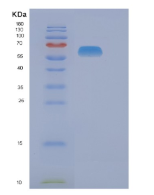 Recombinant Human NAE1 Protein