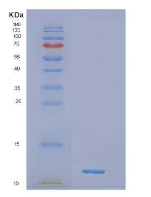 Recombinant Human NDUFB4 Protein