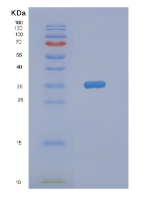 Recombinant Human NMNAT2 Protein