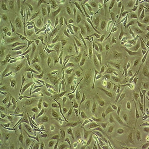 HEC-1-A细胞