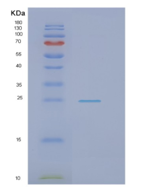 Recombinant Human NRK1 Protein