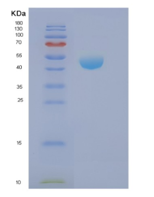 Recombinant Human NCK2 Protein