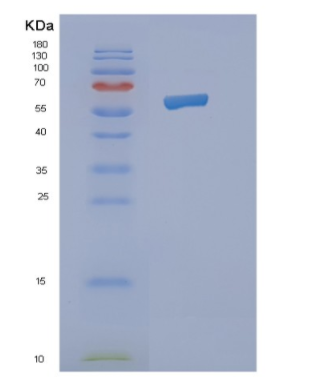 Recombinant Human NMT2 Protein