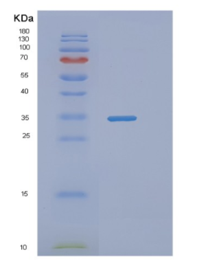 Recombinant Human NAPA Protein
