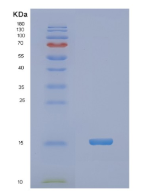 Recombinant Human NDUFA5 Protein