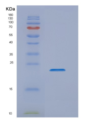 Recombinant Human NKIRAS1 Protein
