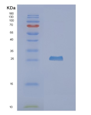 Recombinant Human NUDT5 Protein