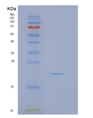 Recombinant Human NRAS Protein