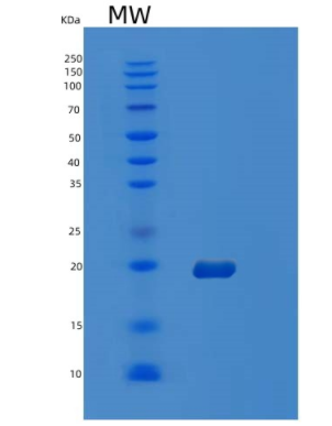 Recombinant Human OCIAD2 Protein