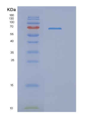 Recombinant Human NRF2 Protein