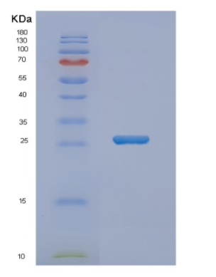 Recombinant Human NUDT14 Protein