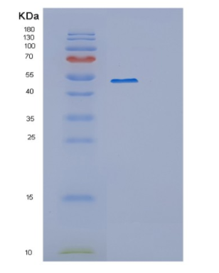Recombinant Human OXSM Protein