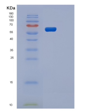 Recombinant Human OXSR1 Protein