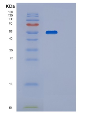 Recombinant Human P4HB Protein