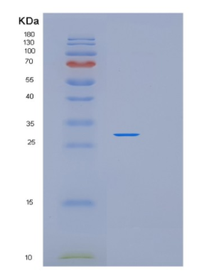 Recombinant Human PDCL3 Protein