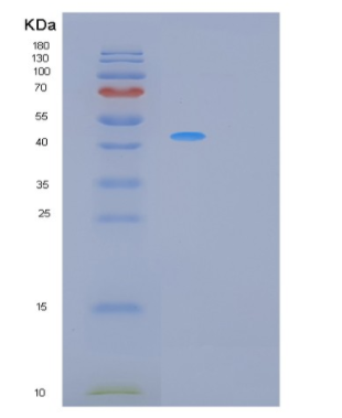 Recombinant Human PCOLCE Protein