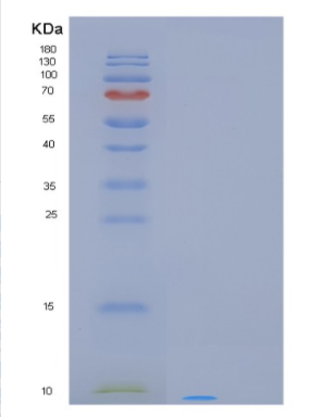 Recombinant Human PCP4L1 Protein