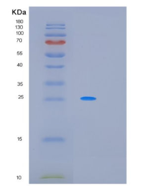 Recombinant Human PCSK1N Protein