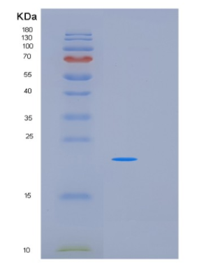 Recombinant Human PDAP1 Protein