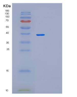 Recombinant Human PBK Protein