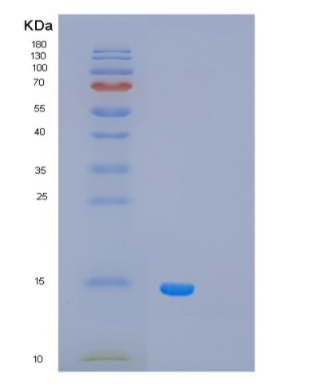 Recombinant Human PCBD1 Protein
