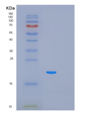 Recombinant Human PCBP1 Protein