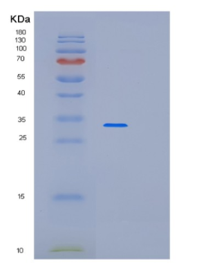 Recombinant Human PARVA Protein