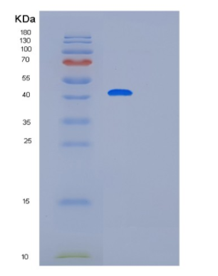 Recombinant Human PARD6B Protein
