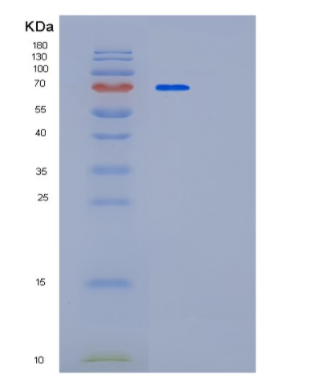 Recombinant Human PAPSS1 Protein