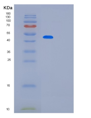 Recombinant Human PAICS Protein